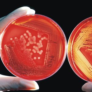 Bacteriile devin tot mai rezistente la dezinfectanţi