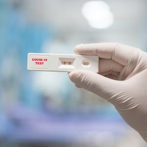 "Testele rapide antigen nu reprezintă un instrument fiabil pentru diagnosticul infecţiei cu SARS COV 2"