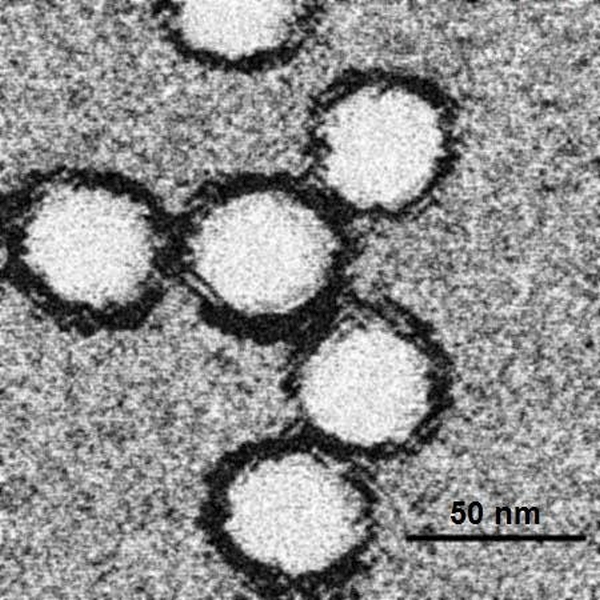 Microscopia electronică a virusului West Nile (Sursa foto: Wikipedia)