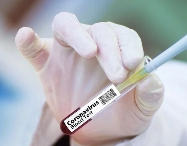 Vaccinul chinezesc împotriva Covid-19, aşteptat să fie produs în masă anul acesta