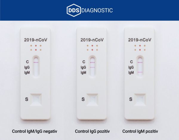 Compania DDS Diagnostic a creat prima trusă din Europa pentru detectarea rapidă a COVID-19