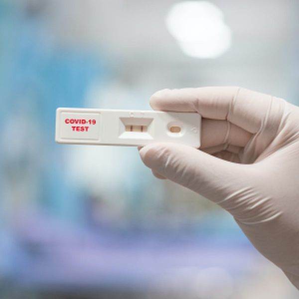 Testele rapide antigen SARS-CoV-2 costă între 30 şi 68 de lei 